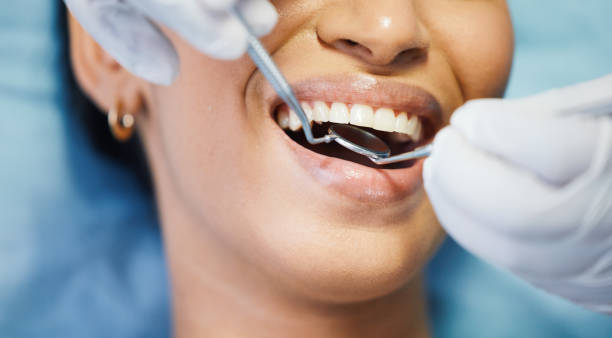 Best Broken Tooth Emergency  in Covington, GA